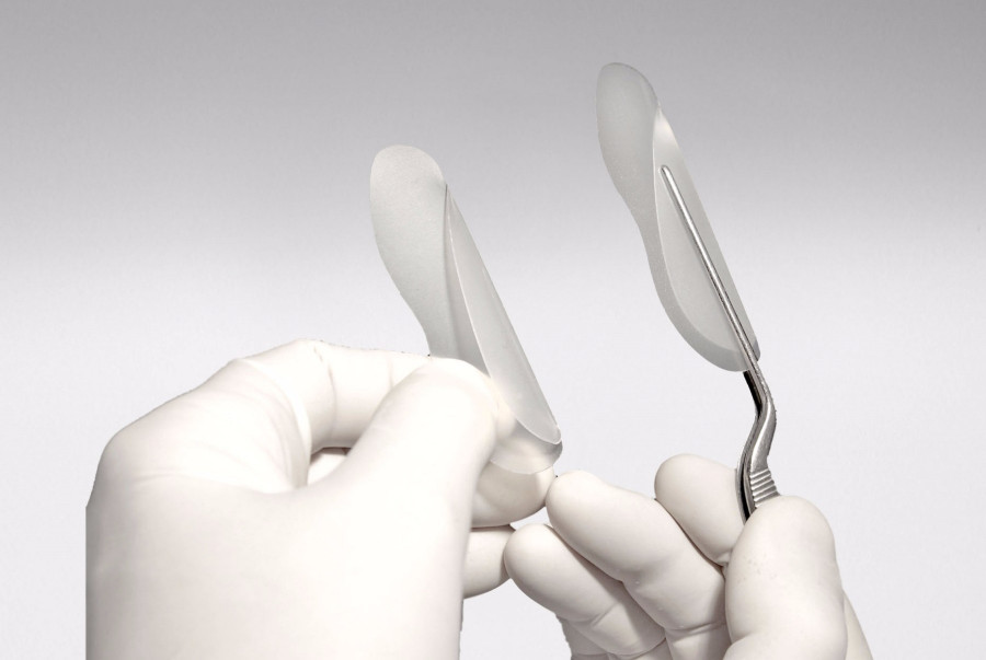 Internal nasal splints
